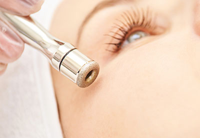 Diamant-Microdermabrasion Teaser - Beauty in Gerresheim